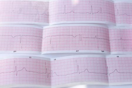 الفرق بين ارتجاع وارتخاء الصمام الميترالي