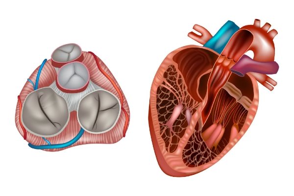 علاج ضيق وارتجاع الصمام الميترالي