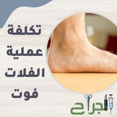 تكلفة عملية الفلات فوت