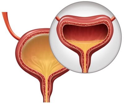 عملية حقن المثانة العصبية بالبوتوكس