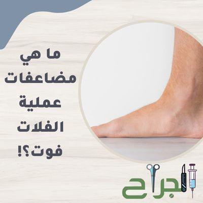 مضاعفات عملية الفلات فوت