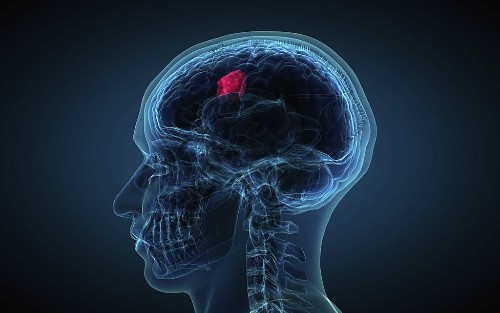 أعراض سرطان الدماغ