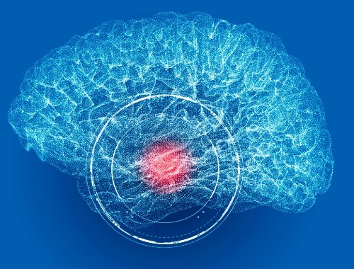 الورم في الدماغ