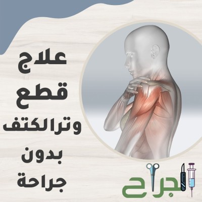 علاج قطع وتر الكتف بدون جراحة