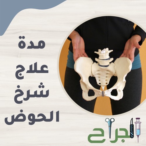 مدة علاج شرخ الحوض