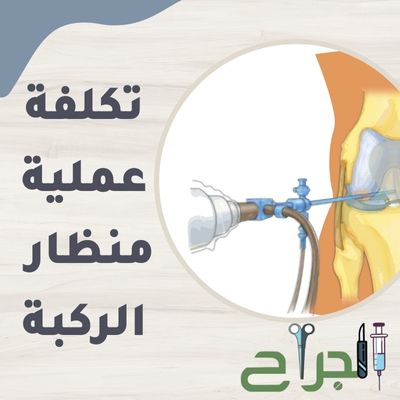 تكلفة عملية منظار الركبة