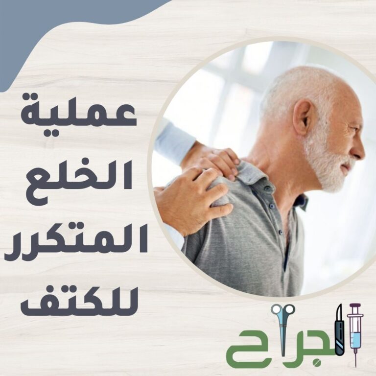 عملية خلع الكتف التكلفة والمضاعفات و 5 معلومات تهمك